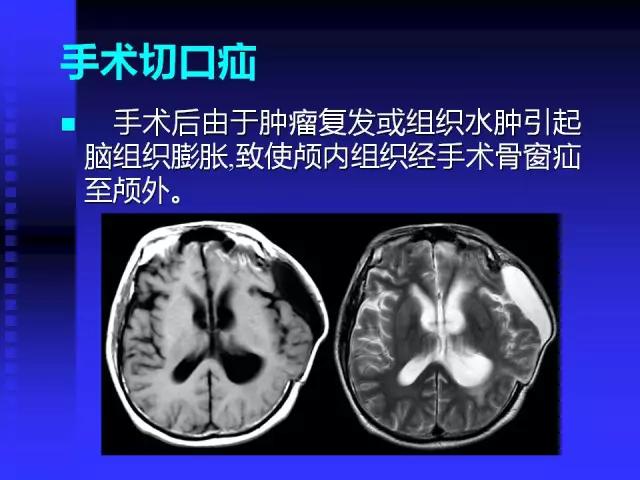 头颅mri读片视频教程,颅脑mri读片入门教程视频讲解全集