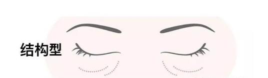 有黑眼圈怎么办如何去除黑眼圈,有黑眼圈该怎么办才能消除黑眼圈