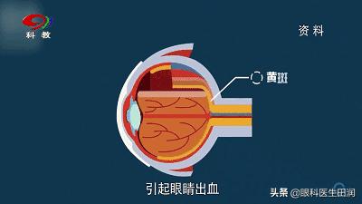 鎯呬汉鎸戞垬鑸炶箞瑙嗛,鎯呬汉鑸炶箞鎸戞垬