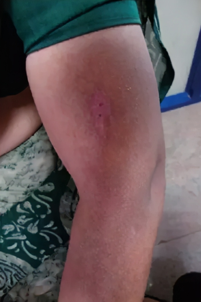 小米生态进军“搓澡业”？电动“小手”自动搓泥，不费力身体变白