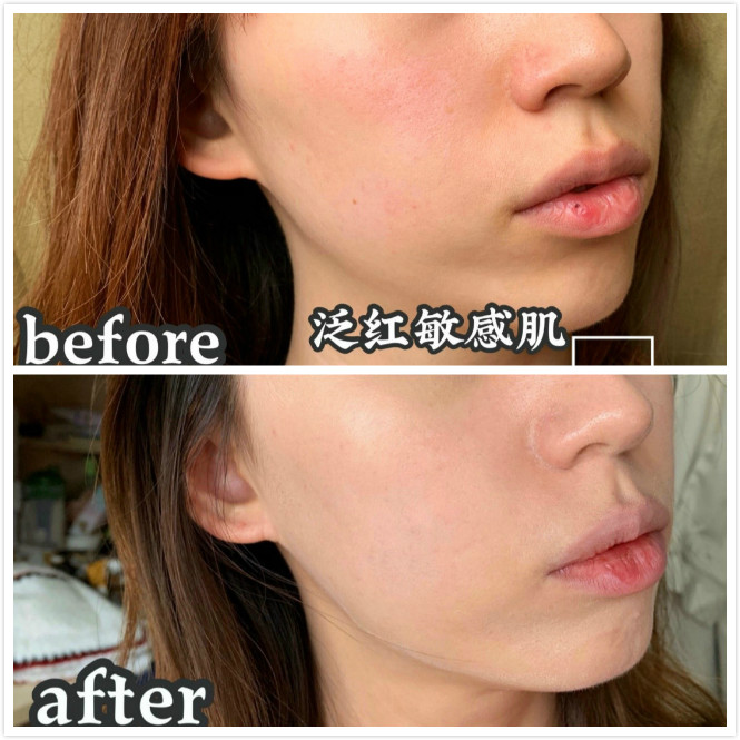 敏感肌适合用的气垫哪个牌子好,敏感肌适合用哪种大牌气垫