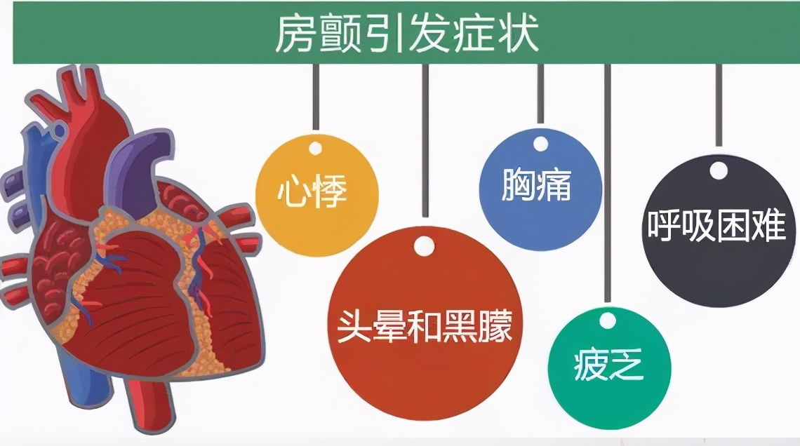 发病心脏难受怎么办,脑梗死导致心房颤动