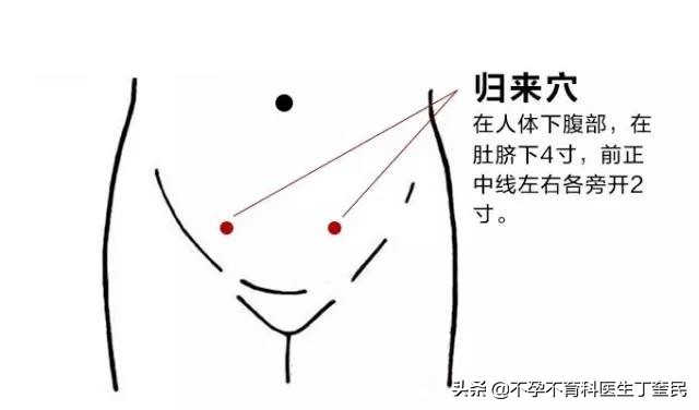 艾灸助孕穴位全图,艾灸助孕要注意什么