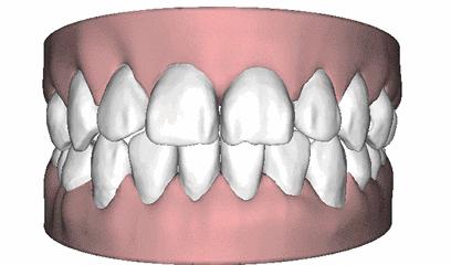 淄博诺尔曼齿科种牙怎么样,淄博诺尔曼齿科整牙费用