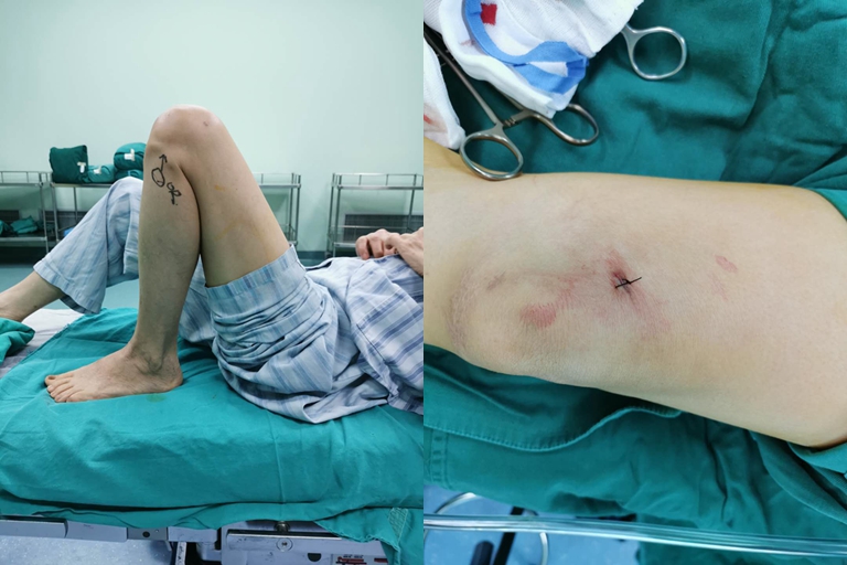 阿婆路边摔伤,阿婆摔倒了被扶起来