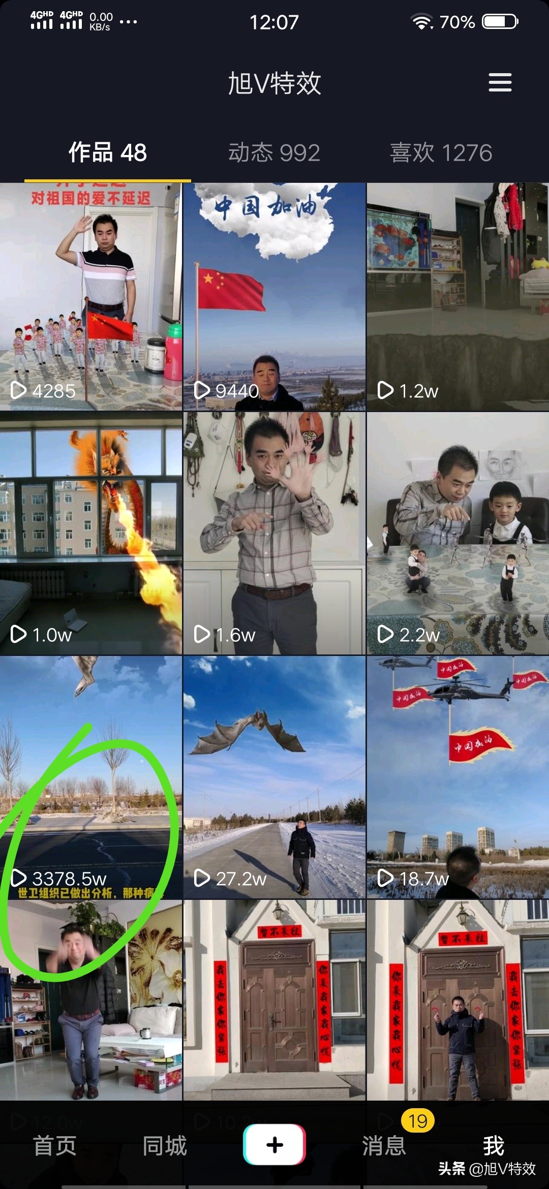 怎么迅速涨粉到1000抖音粉,抖音如何从0到10万粉丝的涨粉策略