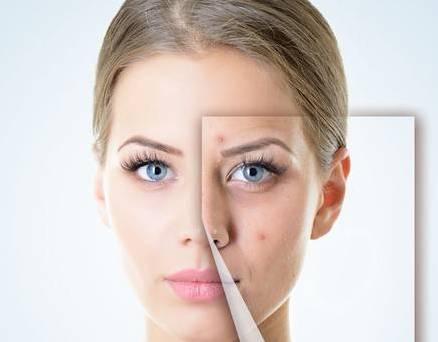 华亦俏朱红博士说：祛痣应该注意什么？