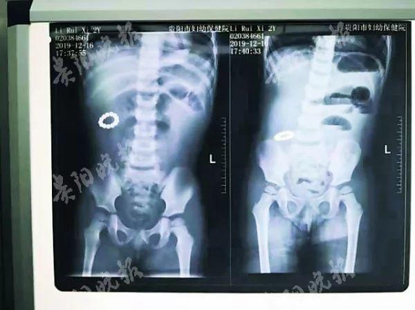 磁力珠危险的玩具不要给孩子玩了,警惕磁力珠玩具危险