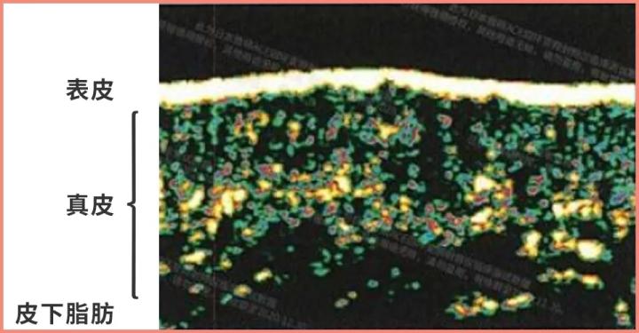 测评家用美容仪真的有用吗,网红推荐的美容仪有用吗