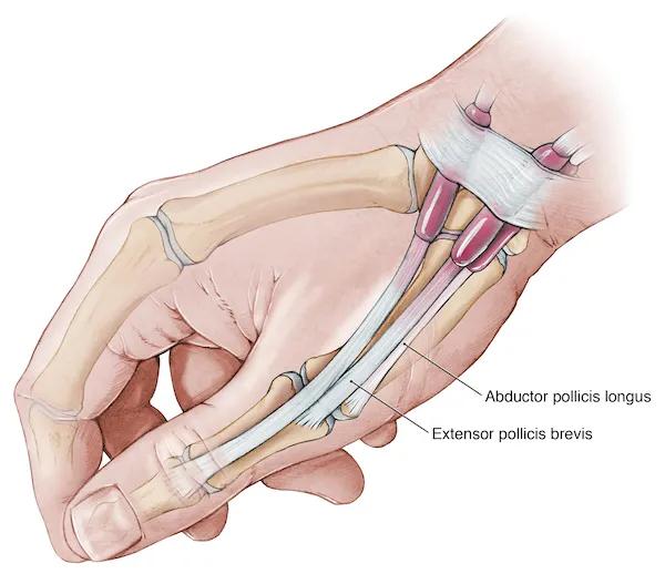 双手麻木怎么办及时检查找到原因,双手发麻做什么检查