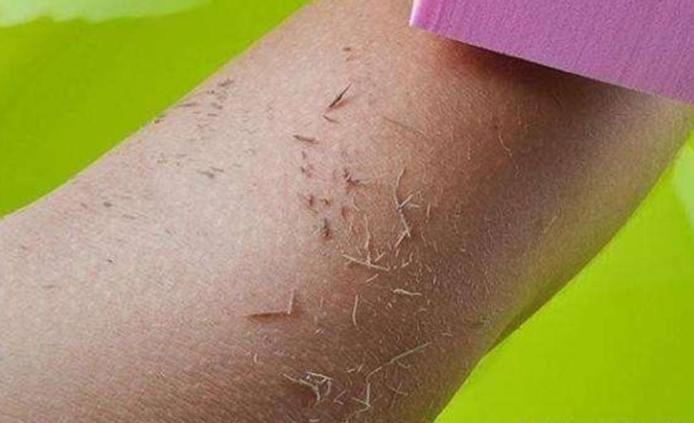 洗澡的时候搓出来的泥是什么,搓澡下来的白条是什么