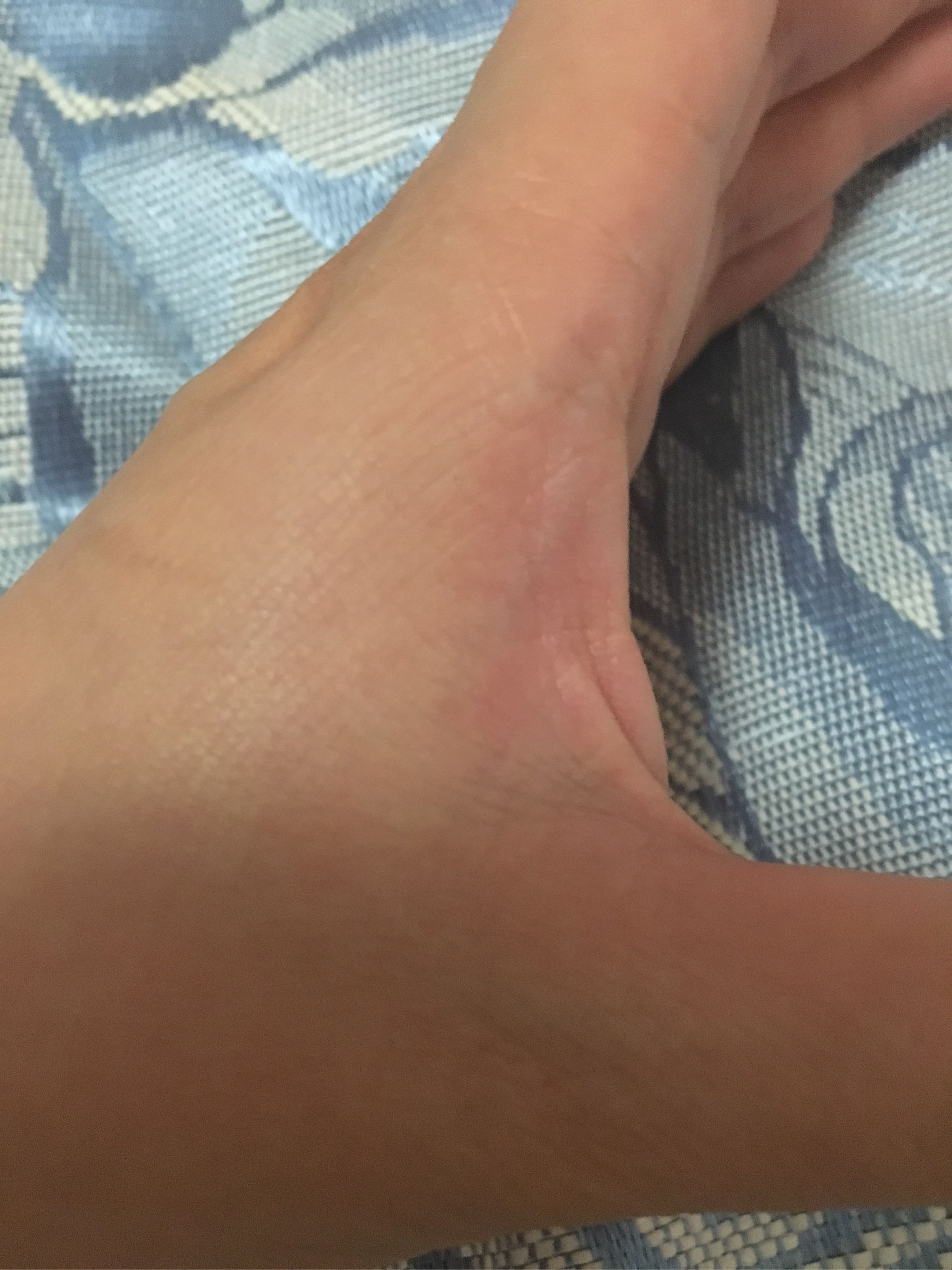 olay小白瓶保湿效果怎么样,olay小白瓶补水保湿怎么样