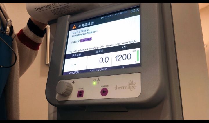 褐青色斑和雀斑哪个容易治疗,色沉和雀斑适合做什么医美项目