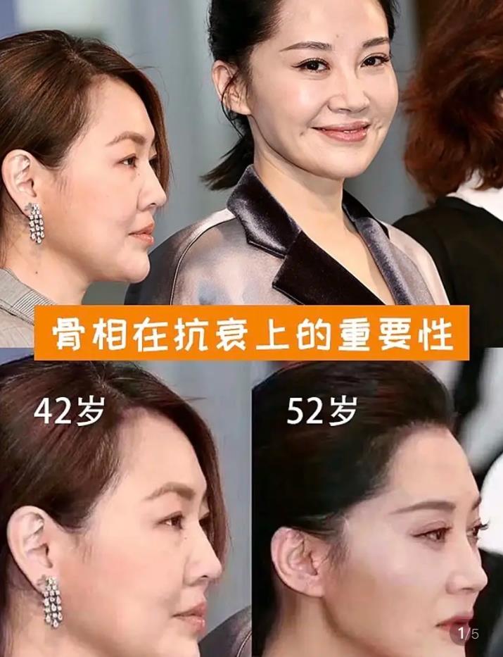 颧骨两边不对称也可以长得好看吗,颧骨突出对五官的要求更高