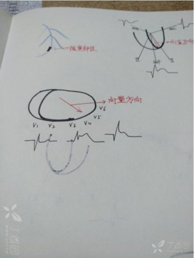 心电图心肌缺血冠脉造影正常,心脏彩超心电图冠脉造影正常