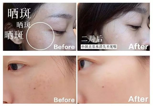 火到断货的“明星级”点斑笔，坚持每天点一下，14天养成初恋脸