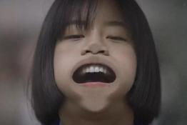 角质层薄毛细血管扩张怎样修复,角质层薄脸颊泛红怎么修复小妙招