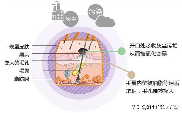 去黑头干货科普如何有效战胜黑头,今日小技巧分享去黑头小妙招