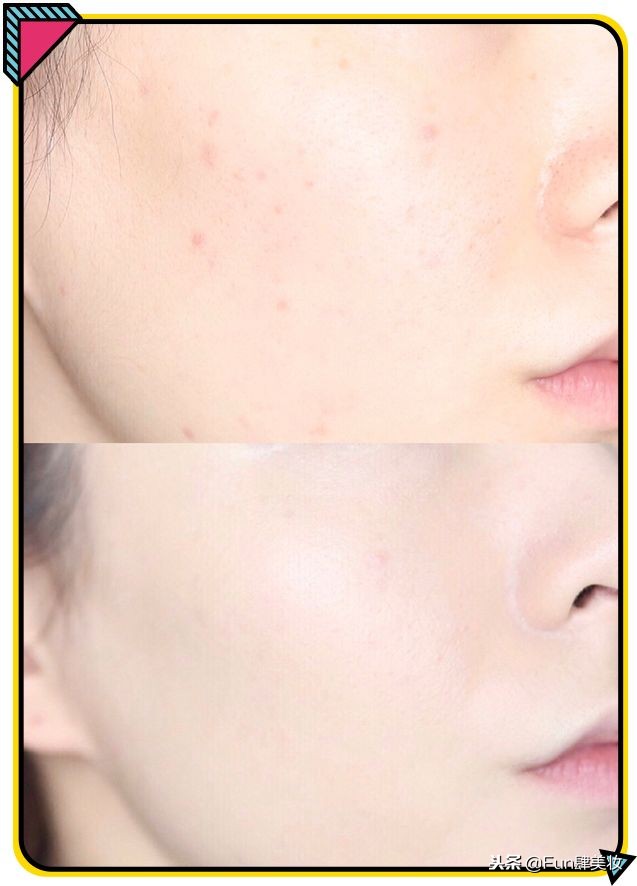 用粉底总是起皮用什么比较服帖,卡粉严重还是不化妆严重