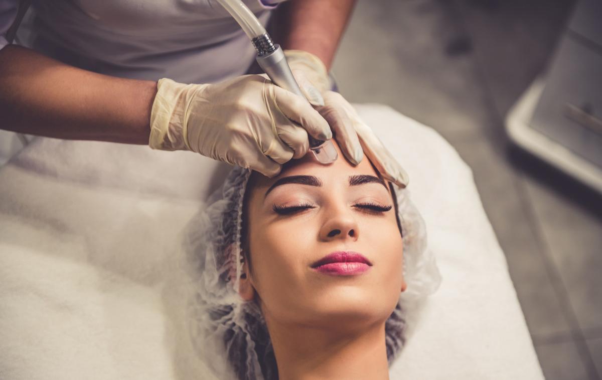 后背痘印怎么去除最快方法,后背痘印做激光可以祛除吗