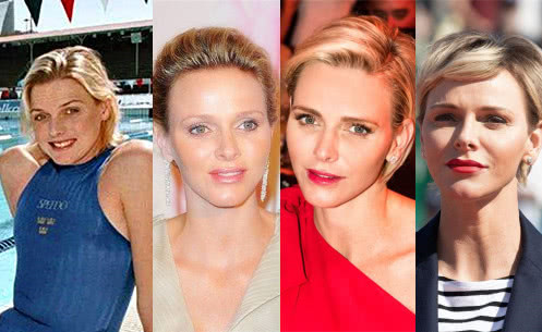 凯特王妃整形了吗,王妃凯特有没有整容