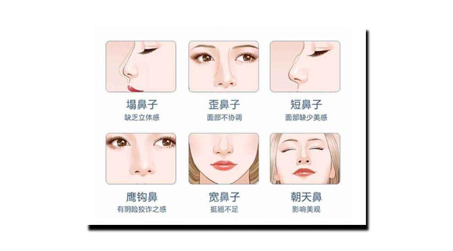 对整鼻子的建议,整鼻子的常识和技巧