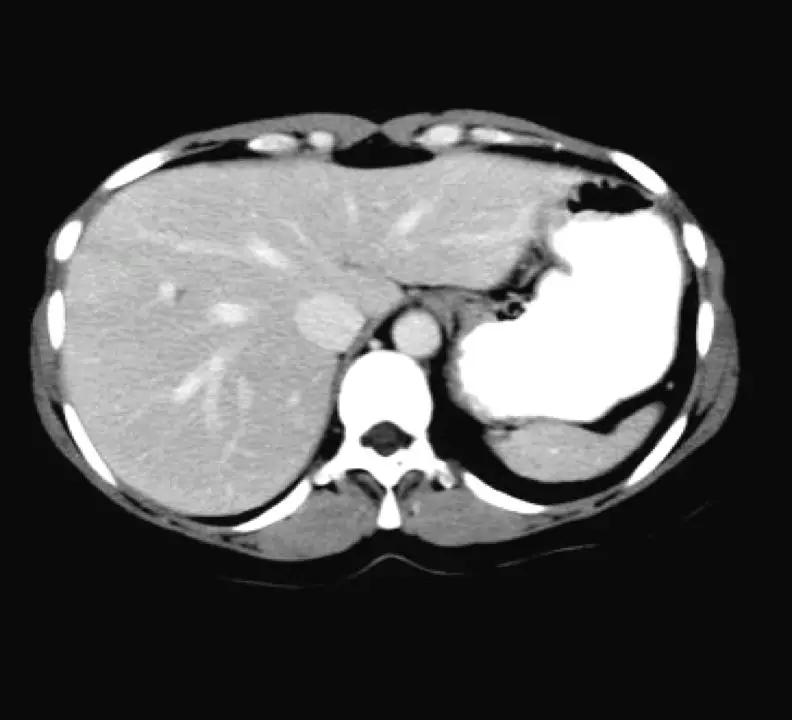 ct图像解析大全,ct图像与实物大小对比