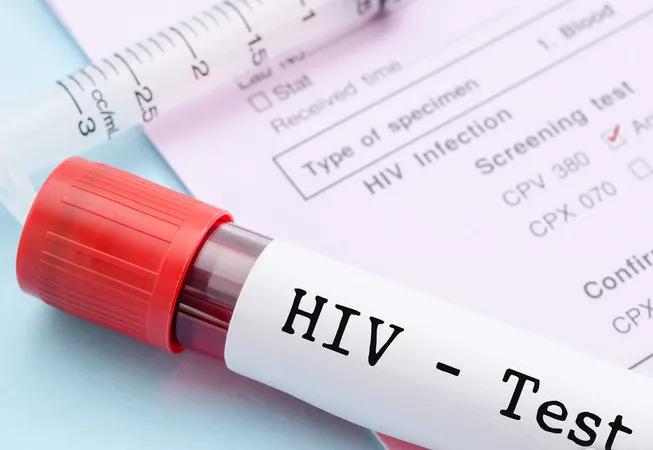 感染了hpv生活中要注意什么,感染了hpv就一定是乱来了吗