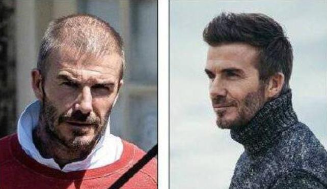 璐濆厠姹夊琚洕鑴卞彂瑙掑害闂,璐濆厠姹夊闈复璋㈤《鍗辨満