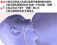 乳头裂伤后喂奶如上刑？应急手册来啦