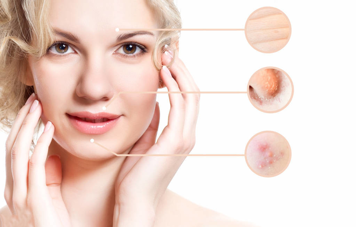 眉心长痘痘是什么原因,眉心长痘痘是怎么回事