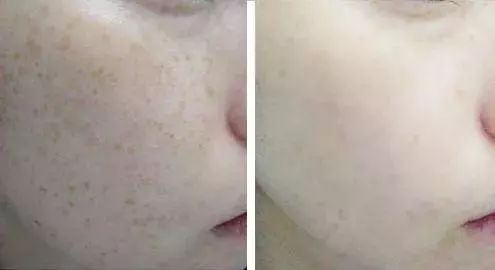 火到断货的“明星级”点斑笔，坚持每天点一下，14天养成初恋脸