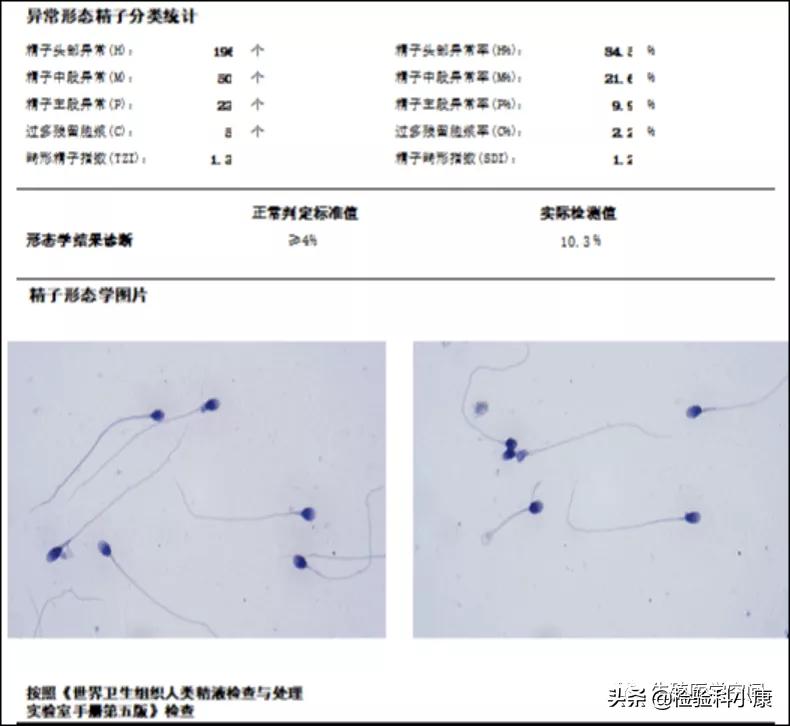 检查精子dna碎片报告怎么看,精子检查哪几项才知道是不是正常