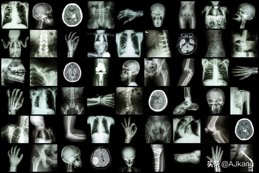 大豆异黄酮与黄豆苷元区别,大豆异黄酮天然雌激素好吗