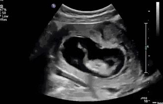 正常怀孕多少周能感觉到胎动,怀孕多久感知胎动