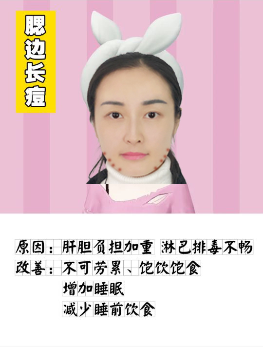 脸上各个位置长痘痘的原因是什么,脸上痘痘的种类及图片