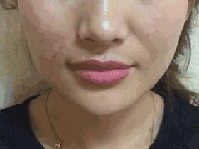 年龄大的怎样遮眼袋法令纹,脸上的法令纹怎么就快速去除了