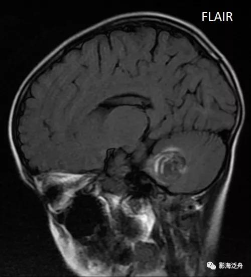 棰呰剳纾佸叡鎸痙wi搴忓垪,棰呰剳dwi搴忓垪鏈鏄庢樉寮傚父
