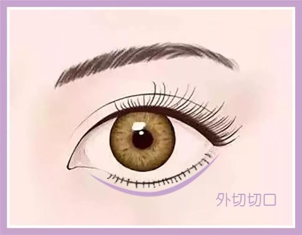 去眼袋最好的方法小红书,消除眼袋的护肤品安利