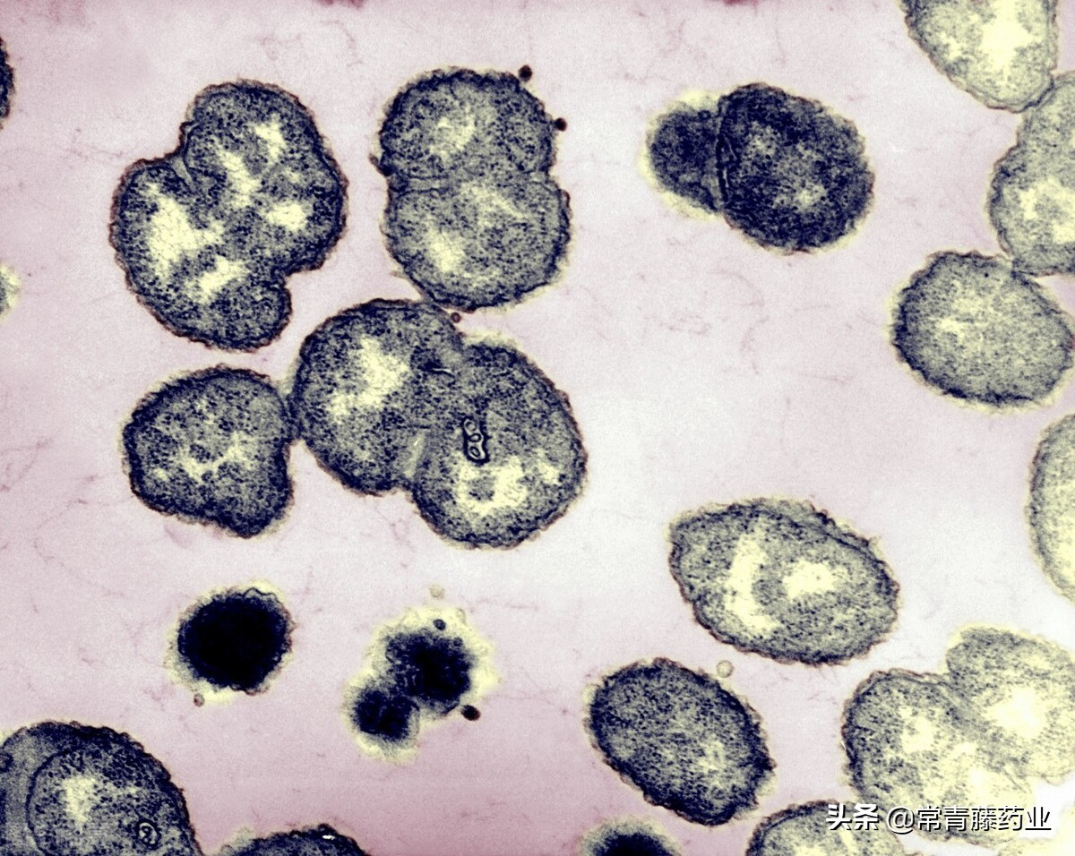 淋病是怎么传染的可以根治吗,淋病女性的症状一般几天可以治愈