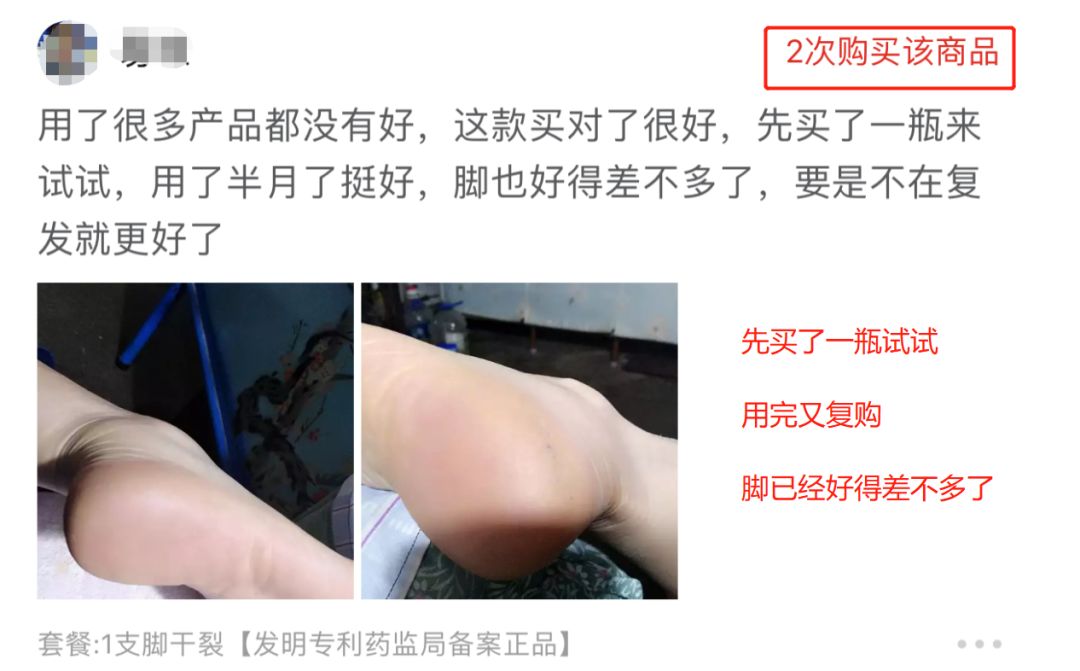 冬季皲裂膏预防脚后跟干裂好用的,上热门脚后跟干裂保湿霜