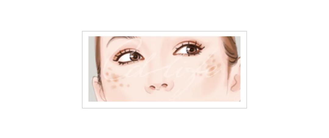 不做黄脸婆教你如何淡化色斑,色斑修复的最佳方法