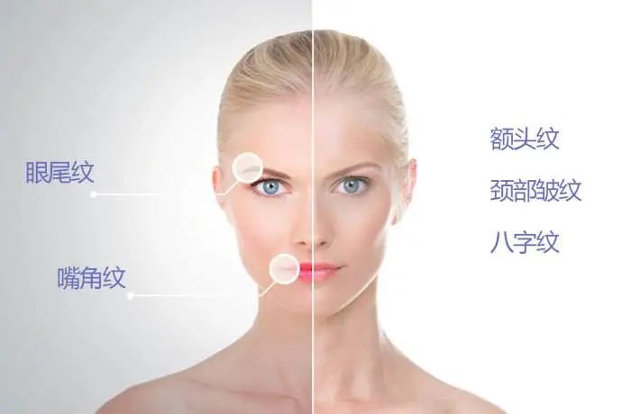 打瘦脸失败的案例,打瘦脸针出事故