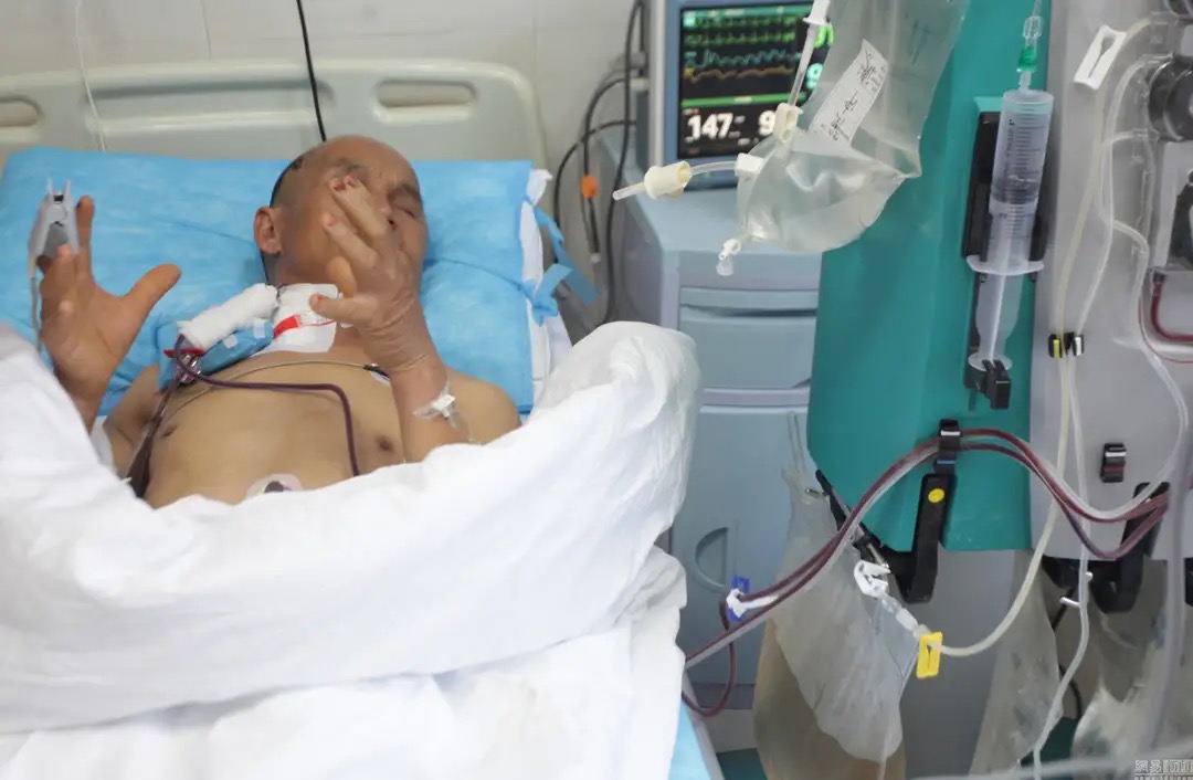 被马蜂蜇伤是意外事件,被马蜂蛰伤怎么救治