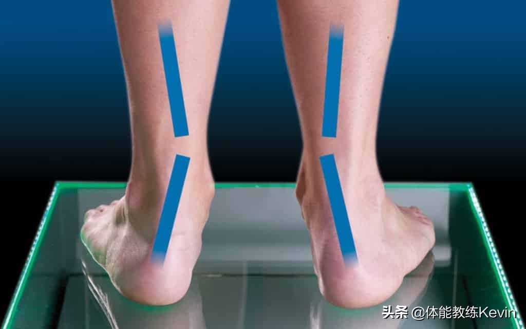 一个动作改善足外翻,足外翻怎么练习走路姿势