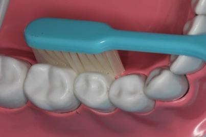 牙周病真实事件,牙周病危害大吗