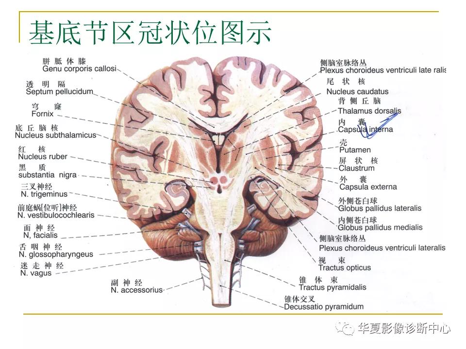 中国人脑立体定向mri应用解剖图谱,脑mri示意图