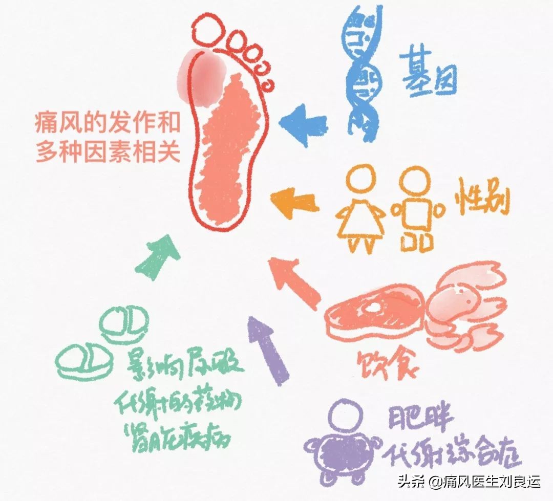 痛风是尿酸高的时候发作吗,痛风发作期间尿酸忽高忽低为什么