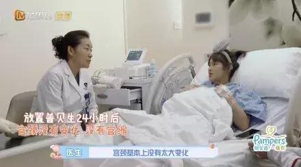 陈燃48小时宫缩乏力只能顺转剖：这几种情况不能再顺