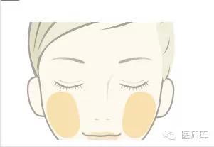 什么是线雕美容过程,什么是线雕眉